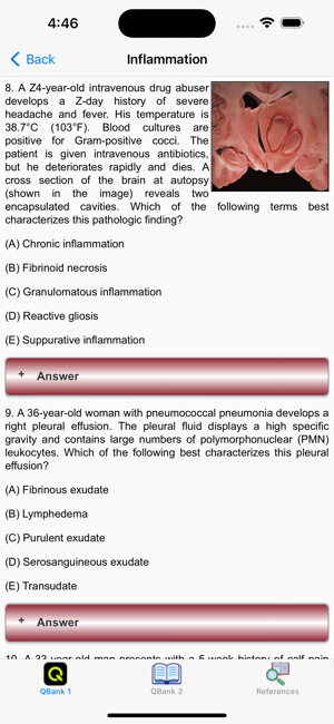 Pathology for the USMLE ExamsiPhone版截图3